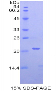 Recombinant Peroxisome Proliferator Activated Receptor Delta (PPARd)