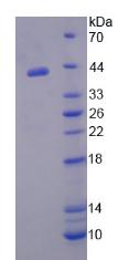 Recombinant Liver X Receptor Alpha (LXRa)