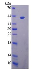 Recombinant Liver X Receptor Alpha (LXRa)