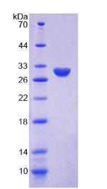 Recombinant Ki-67 Protein (Ki-67)