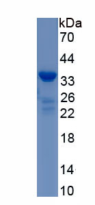 Recombinant Ki-67 Protein (Ki-67)