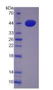 Recombinant Phospholipase D (PLD)