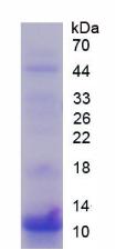 Recombinant S100 Calcium Binding Protein P (S100P)