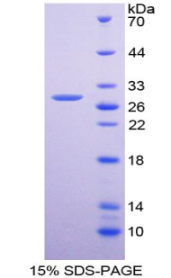 Recombinant Platelet Derived Growth Factor Receptor Alpha (PDGFRa)