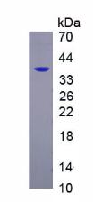 Recombinant Platelet Derived Growth Factor Receptor Beta (PDGFRb)