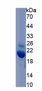 Recombinant Interleukin 24 (IL24)