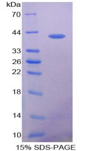 Recombinant VEGF Co Regulated Chemokine 1 (VCC1)