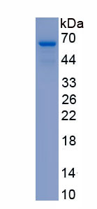 Recombinant Laminin Beta 2 (LAMb2)