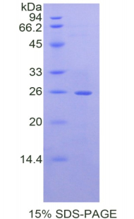 Recombinant Laminin Beta 2 (LAMb2)