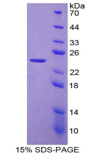 Recombinant Laminin Beta 2 (LAMb2)