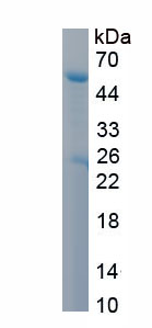 Recombinant Laminin Gamma 2 (LAMC2)