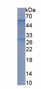 Recombinant Laminin Gamma 3 (LAMC3)