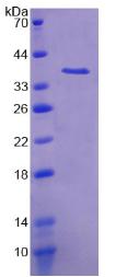 Recombinant Major Histocompatibility Complex Class I B (MHCB)