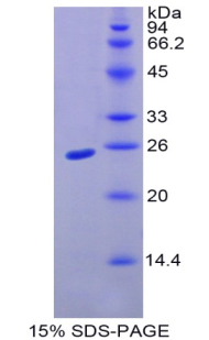 Recombinant Integrin Alpha 10 (ITGa10)