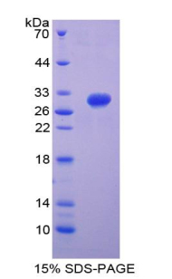 Recombinant Integrin Beta 5 (ITGb5)