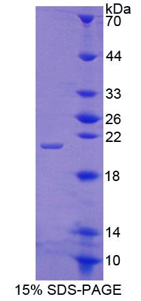 Recombinant Integrin Beta 8 (ITGb8)