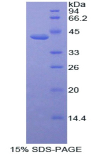 Recombinant Activin A Receptor Type II A (ACVR2A)