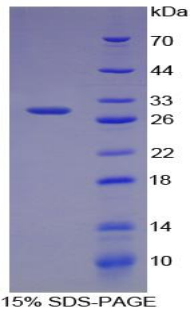 Recombinant Chordin (CHRD)