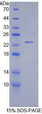 Recombinant Gremlin 1 (GREM1)