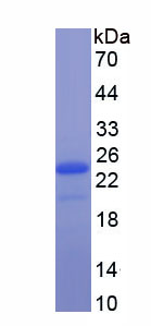 Recombinant Gremlin 1 (GREM1)