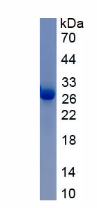 Recombinant Noggin (NOG)