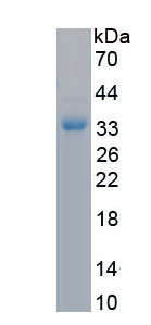 Recombinant Collagen Type XIII (COL13)