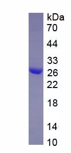 Recombinant HLA Class II Histocompatibility Antigen, DRB1 Beta Chain (HLA-DRB1)
