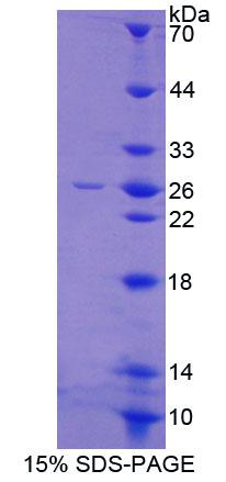 Recombinant Glial Cell Line Derived Neurotrophic Factor Receptor Alpha 2 (GFRa2)