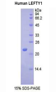 Recombinant Left/Right Determination Factor 1 (LEFTY1)