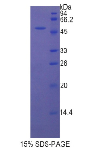 Recombinant Left/Right Determination Factor 1 (LEFTY1)