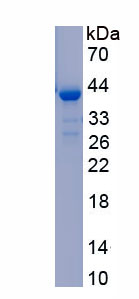 Recombinant Poly A Specific Ribonuclease (PARN)