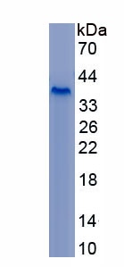 Recombinant Neurocan (NCAN)