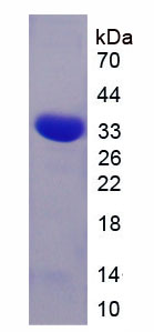 Recombinant Ciliary Neurotrophic Factor Receptor (CNTFR)