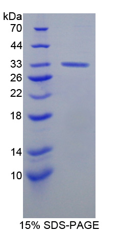 Recombinant V-Erb B2 Erythroblastic Leukemia Viral Oncogene Homolog 3 (ErbB3)