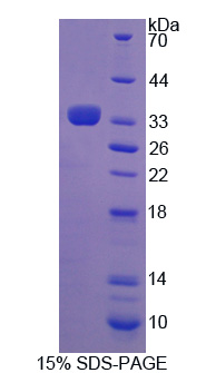 Recombinant Adrenergic Receptor Beta Kinase 2 (ADRbK2)