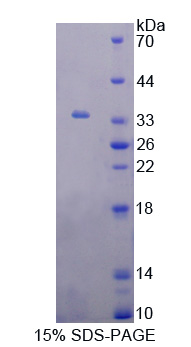 Recombinant G Protein Coupled Receptor Kinase 6 (GRK6)