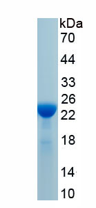 Recombinant Junction Plakoglobin (JUP)