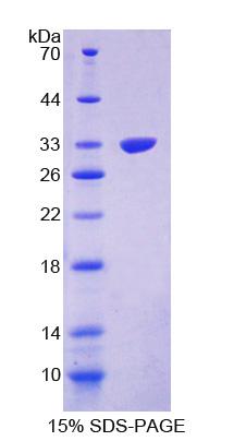 Recombinant Protein Phosphatase 1, Regulatory Subunit 15A (PPP1R15A)