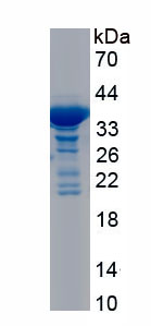 Recombinant Desmoglein 2 (DSG2)