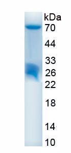 Recombinant Histone Deacetylase 1 (HDAC1)