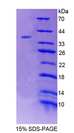 Recombinant Embryonic Ectoderm Development (EED)