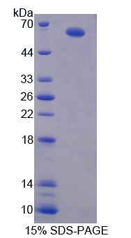 Recombinant Vav 1 Oncogene (VAV1)