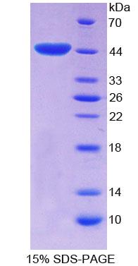 Recombinant E1A Binding Protein P300 (EP300)