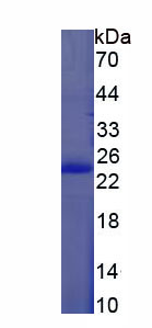 Recombinant Bleomycin Hydrolase (BLMH)