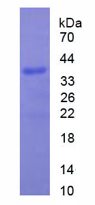 Recombinant Actinin Alpha 4 (ACTN4)