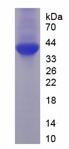 Recombinant Protein Tyrosine Phosphatase, Non Receptor Type 1 (PTPN1)