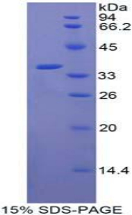 Recombinant C-Raf Proto Oncogene Serine/Threonine Protein Kinase (Raf-1)