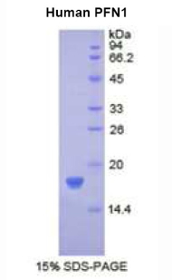 Recombinant Profilin 1 (PFN1)