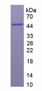 Recombinant Profilin 1 (PFN1)