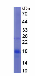 Recombinant Zyxin (ZYX)